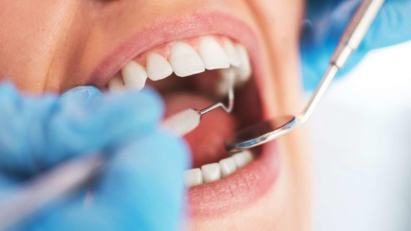 What is a Root Canal? | Advanced Dental Care of Anderson